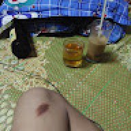 Hungdep